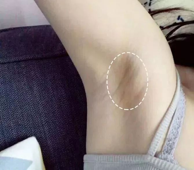 洗屁屁变白的香皂,洗屁屁香皂真的会变白吗