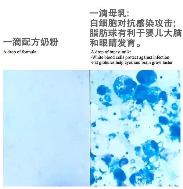 母乳喂养的三大痛苦,母乳喂养的心酸和感受