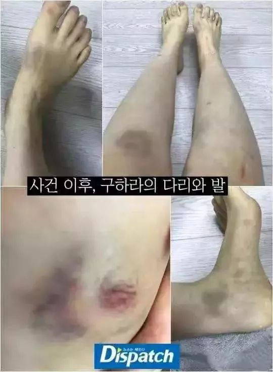 女明星遭前男友*爱性**视频威胁：我的生活，不是你的AV!