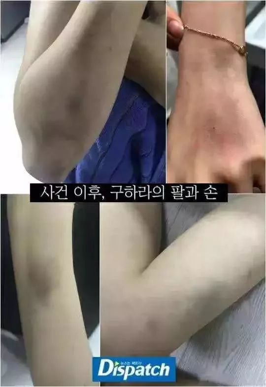 女明星遭前男友*爱性**视频威胁：我的生活，不是你的AV!