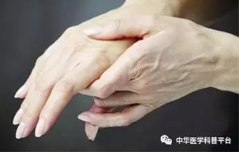 孕期手麻怎么回事,手麻手痒怎么回事