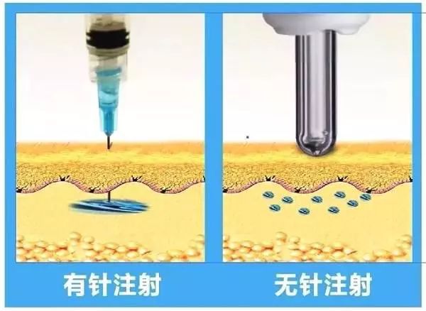 推介一款胰岛素无针注射器,胰岛素注射泵推荐