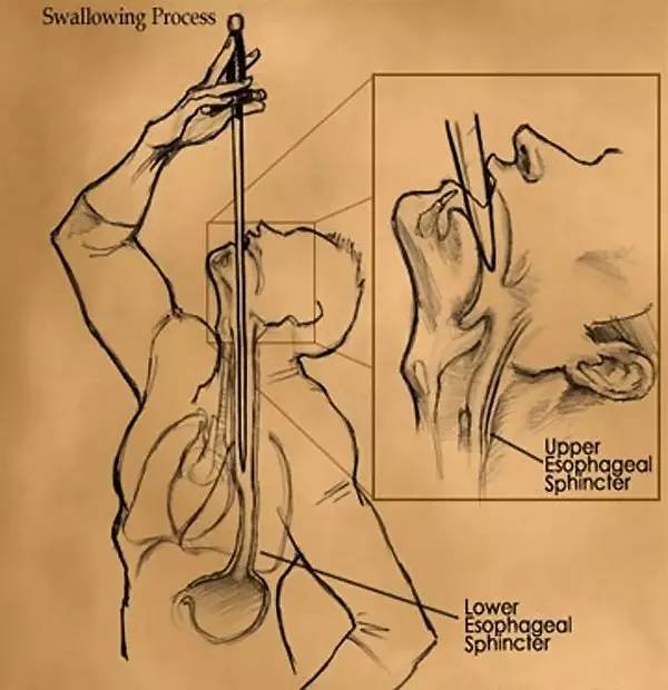 胃部的秘密,做胃镜不痛苦的秘密