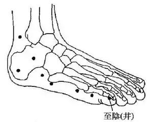 针灸治疼痛药方,针灸治疗各种痛症图解