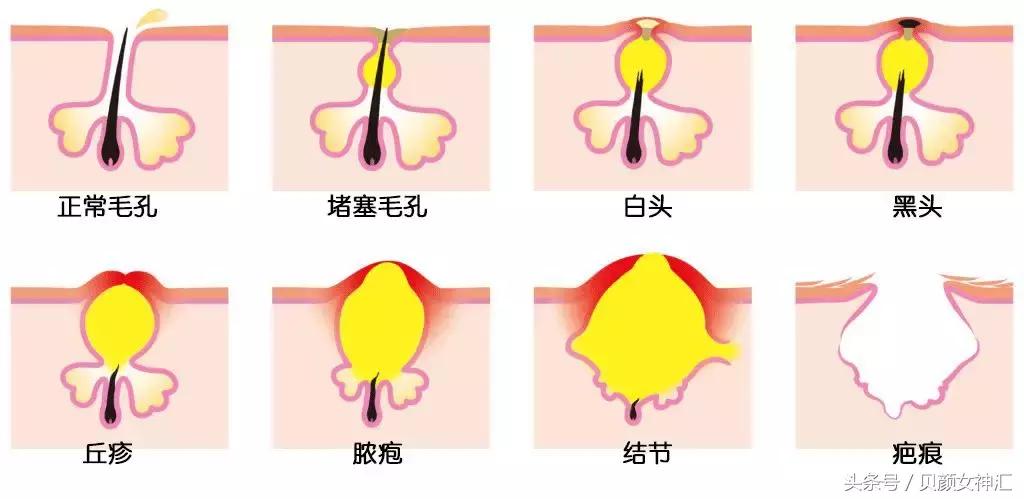 花了几千块美容,花了几十万护肤