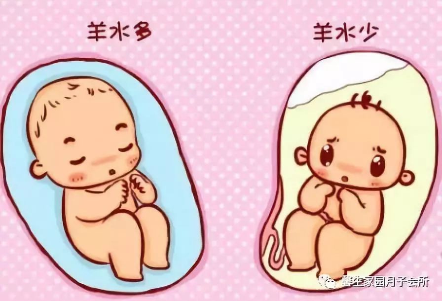 补羊水怎么喝水尿少补得快,孕妇羊水多点是多喝水造成的吗