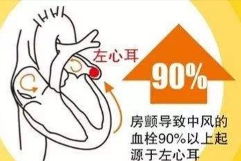 轻微脑梗塞需要关注什么事项,出现轻微的脑梗塞怎么办