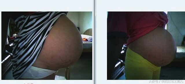 胎儿还没入骨盆是什么意思,胎儿入没入盆b超可以查到吗