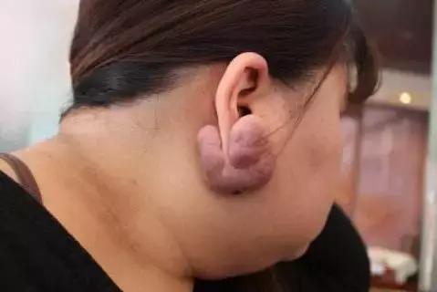 番禺区打耳洞,广州番禺哪家医院可以打耳洞