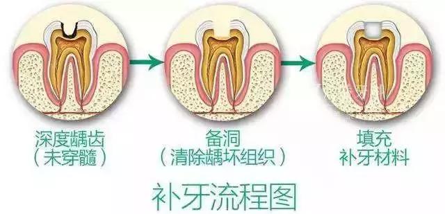 宝宝乳牙磕一小块补救办法,宝宝乳牙磕掉一半需要补吗