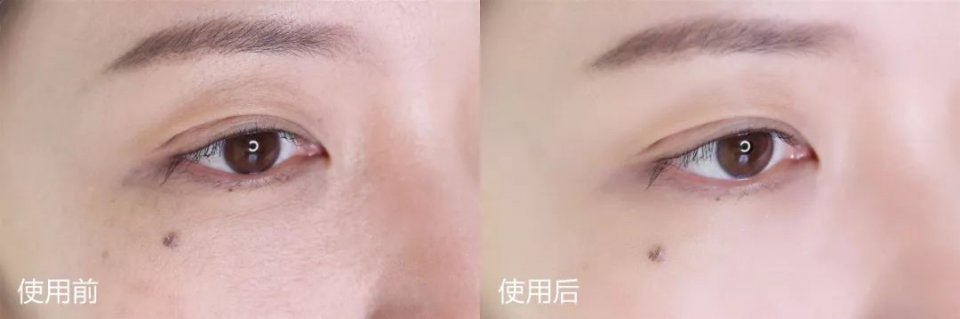 一支眼霜解决你眼周所有问题,一支眼霜