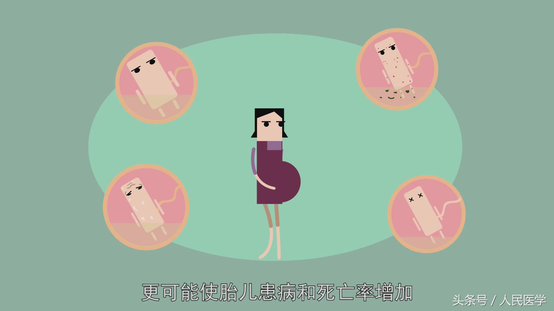 怀孕足月没反应直接剖腹产吗,孕期多少天妊娠反应可以消失