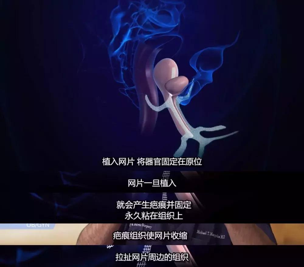 鎯呮劅璋冩煡,鎯呮劅濠氬Щ璋冩煡