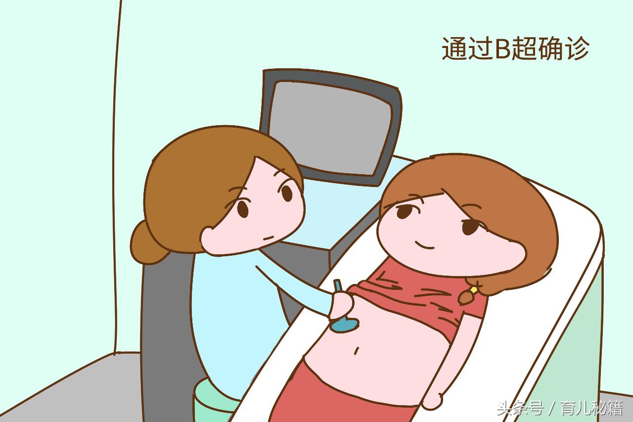 分娩后42天，宝妈别忘记做这几项检查，关乎你的身体恢复