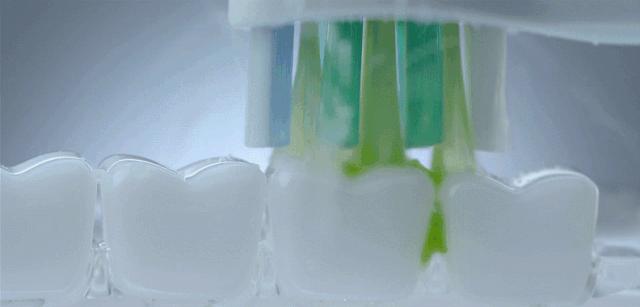 日本黑科技光疗电动牙刷,超声波电动牙刷到底有没有效果