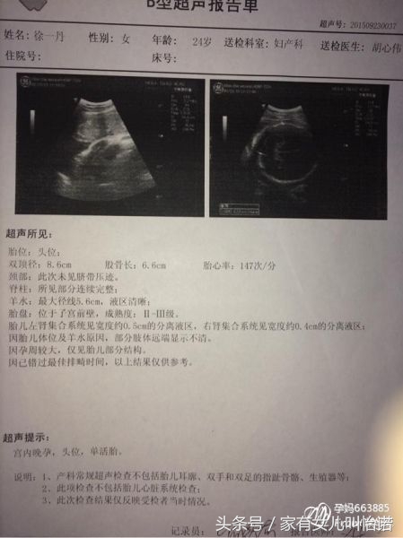 孕妈不头疼，三分钟看懂B超单数据