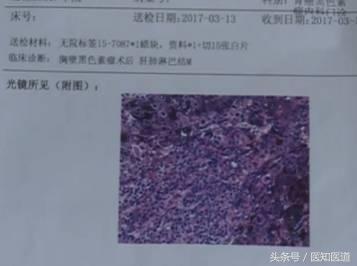 一颗痣周围长很多小痣危险吗,一颗黑痣会不会引起很多小痣