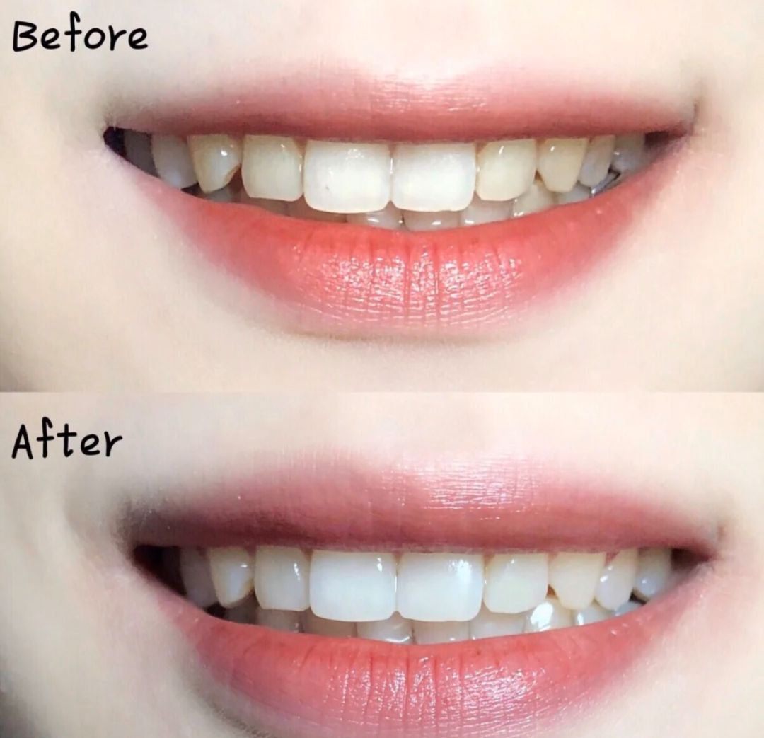 口腔专用香水,能持久留香的口腔香水