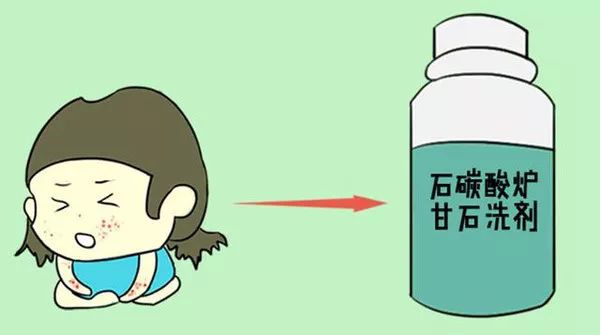夏天宝宝长痱子有什么好办法吗,夏天宝宝长痱子怎么办