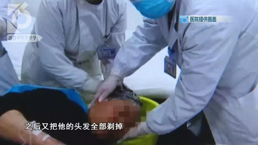 大哥敌敌畏洗头,敌敌畏洗头以毒攻毒的视频