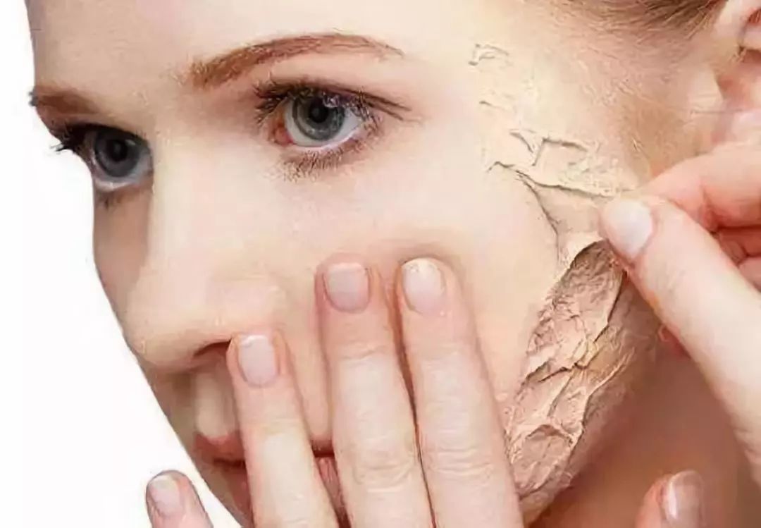 眼部皮肤细纹松弛显老怎么办,改善皮肤松弛的最好方法