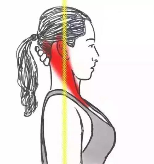 颈部按摩仪可以消除富贵包吗,颈部富贵包快速消除方法