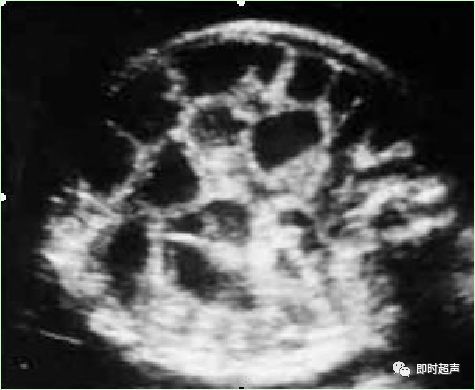 产科常规彩色超声报告单介绍,常见妇科疾病超声报告
