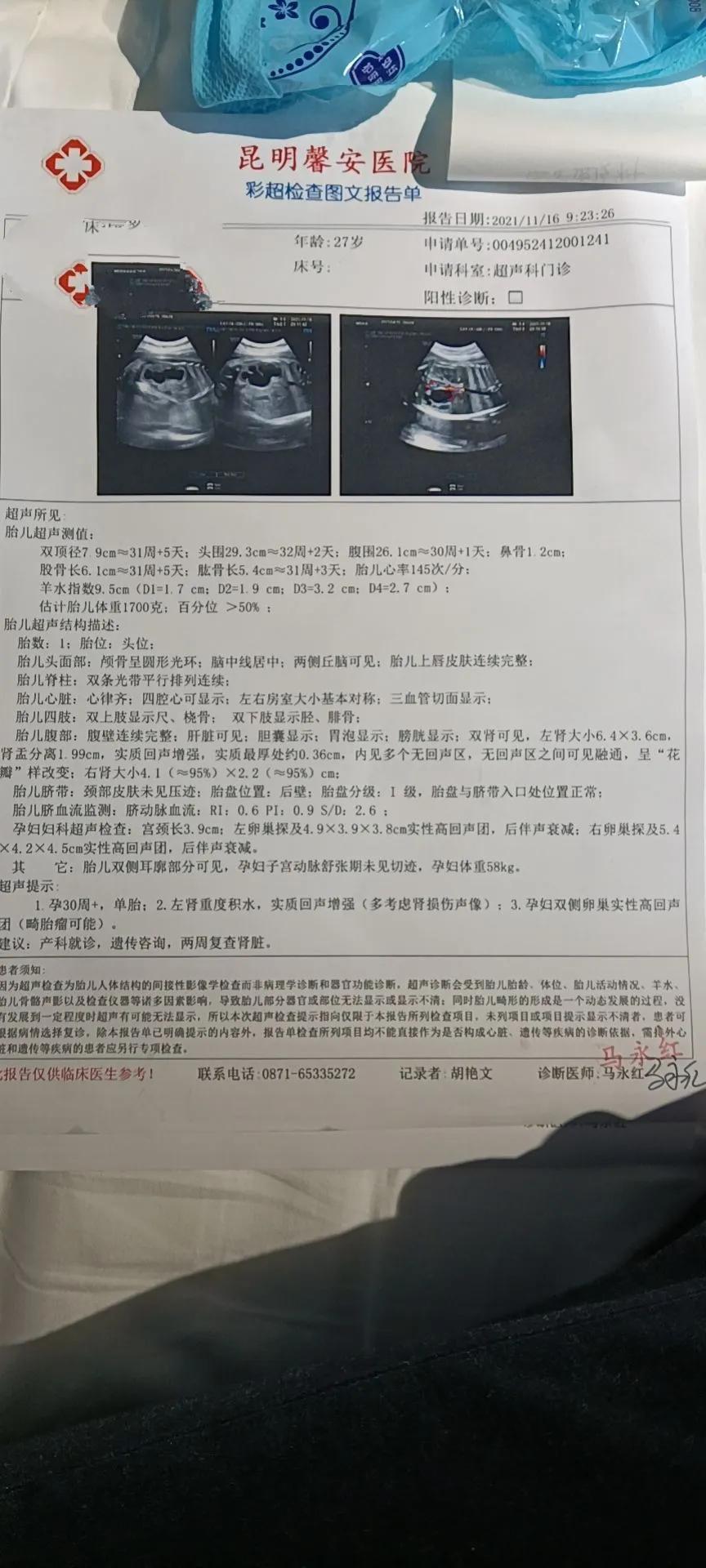 脐血穿刺的正确步骤,脐血穿刺的最佳时间