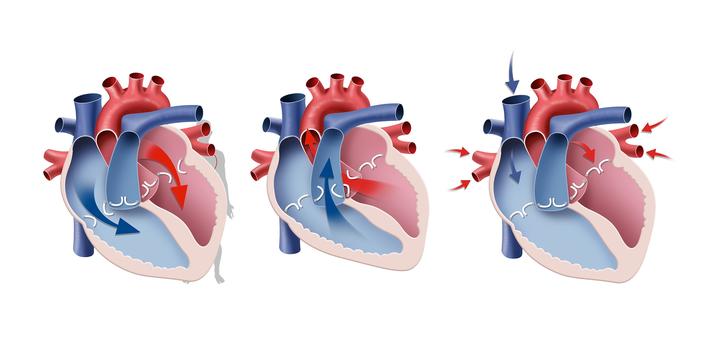 青春痘不要乱挤不然会出事,痘痘不能随便抠