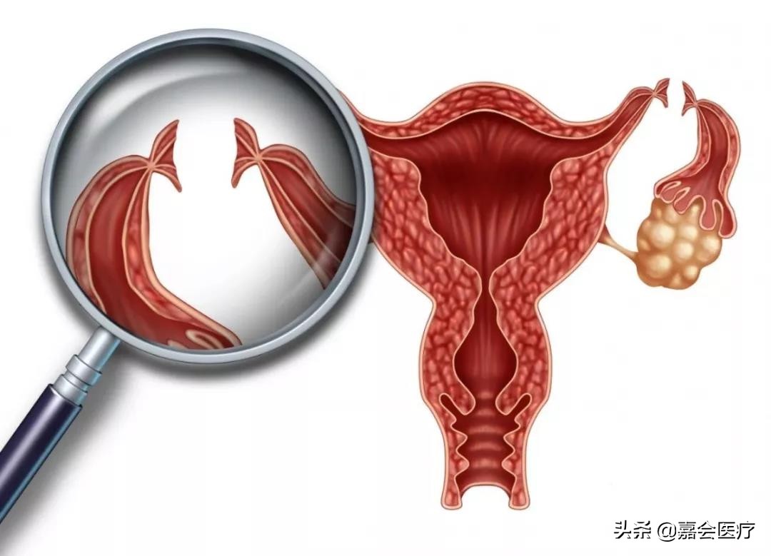 特殊时期易怀孕，避孕方法这么多，你做对了几个？