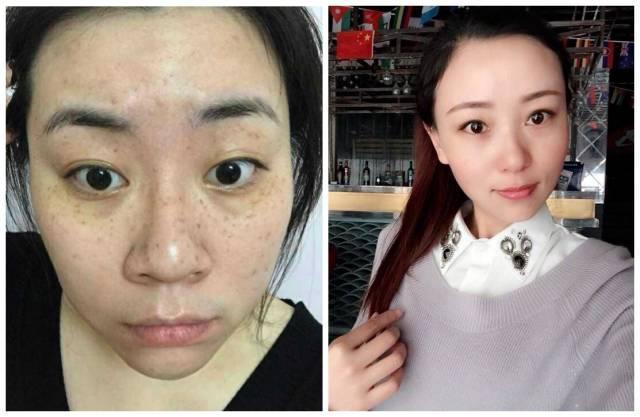 了不起的美白祛斑霜,了不起的国货去除痘印