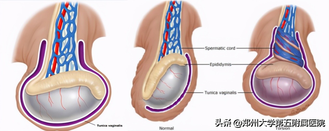 蛋蛋的忧伤原版,蛋蛋的忧伤拳击