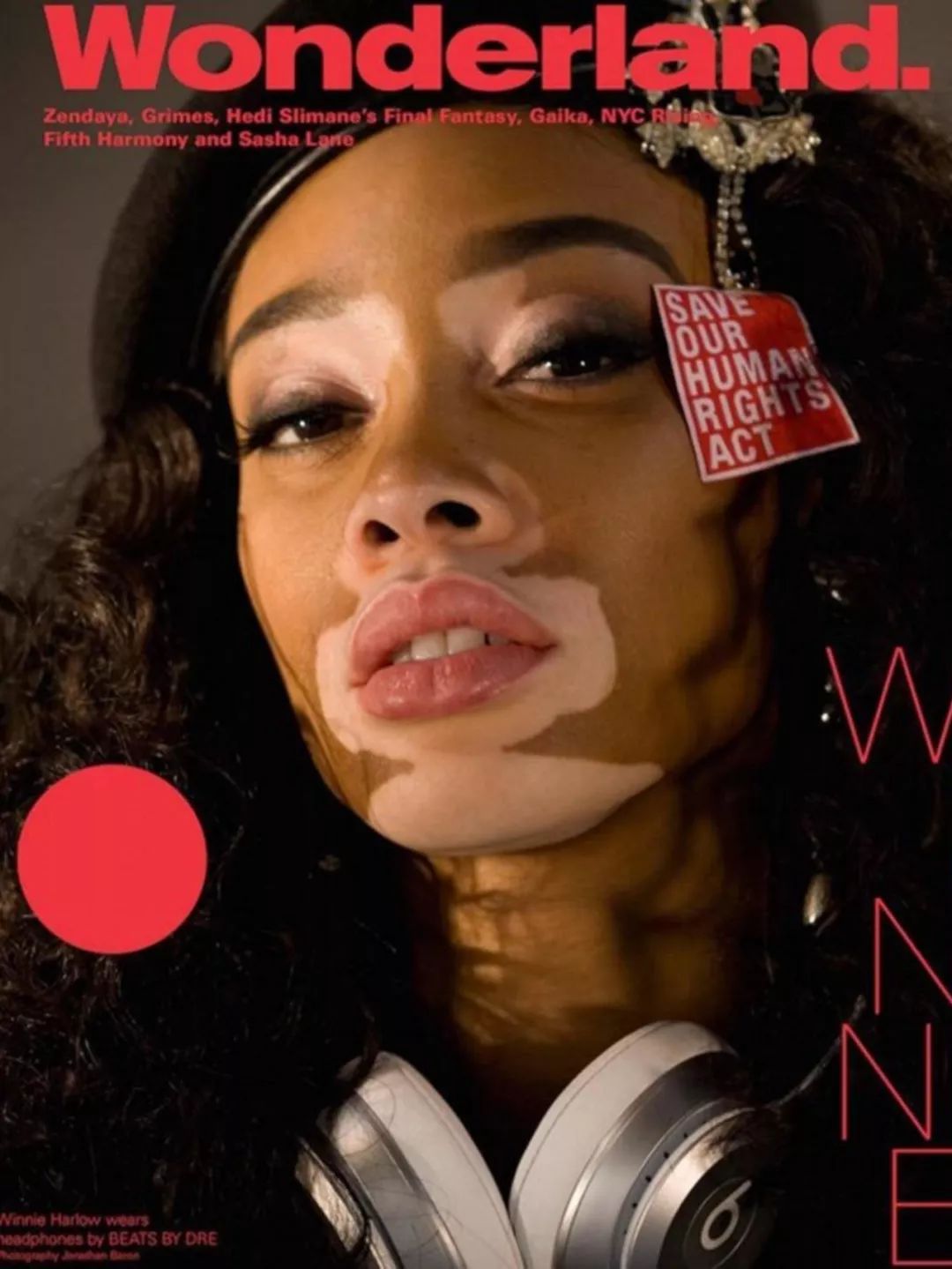 winnieharlow超模大赛,世界顶级超模winnieharlow