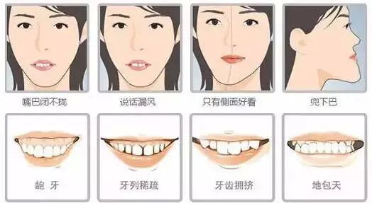 既有牙缝又有露龈笑先矫正哪个,儿童露龈笑最简单改善方法