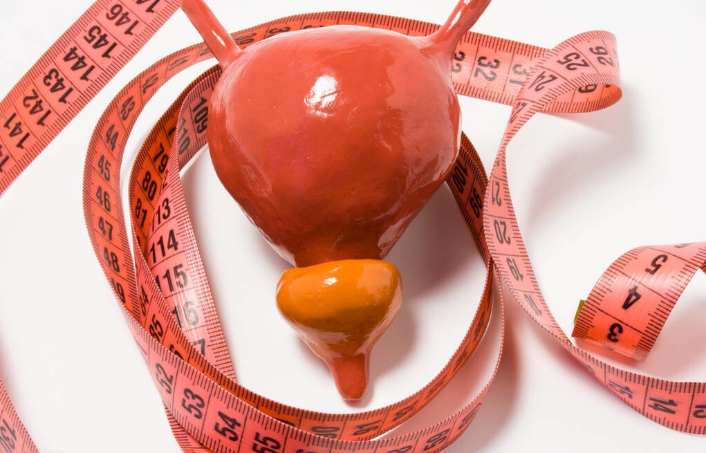 30岁就有前列腺钙化,30岁前列腺肥大并钙化