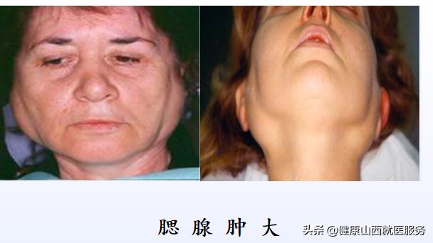 牙齿变黑是哪种疾病的前兆,牙齿全黑腐烂是什么引起的