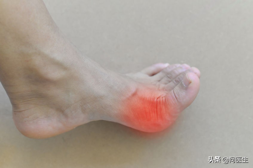痛风手指关节疼痛怎么治疗,痛风关节手指疼痛解决最好办法