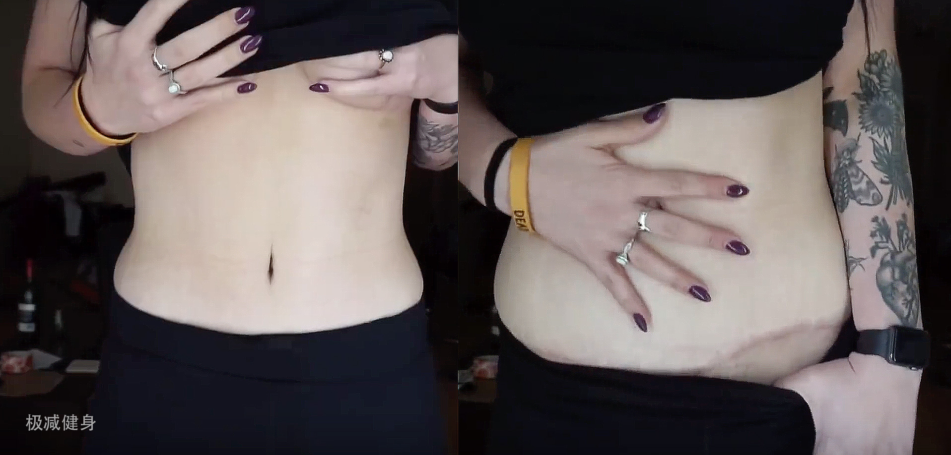 减肥之后皮肤松弛年轻,减肥后皮肤松弛多长时间能恢复