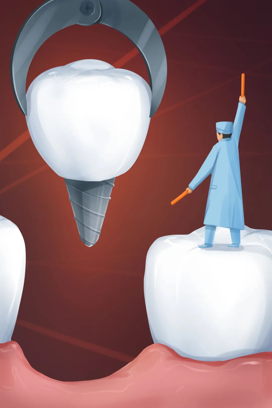 牙坏了怎么办？种植牙原来还有这些“讲究”！