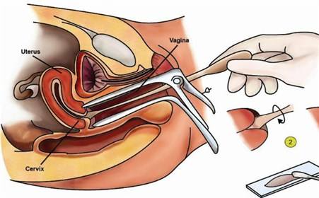 宫颈糜烂严重吗有必要做手术吗,宫颈糜烂需不需要治