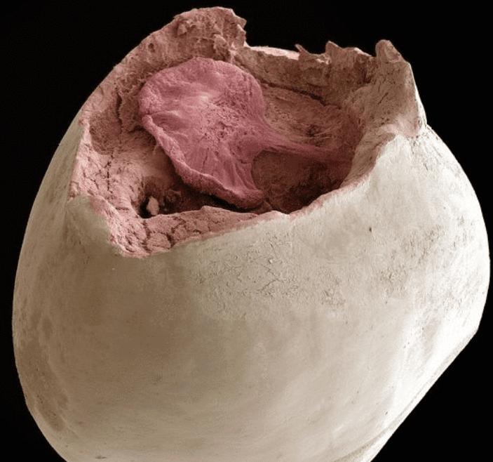 放大两千倍的牙齿表面长什么样？不愧是人体最脏的地方，不堪入目