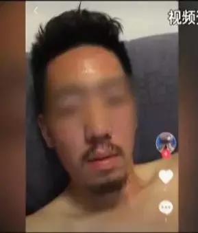 国内公认垃圾面膜曝光事件,央视曝光烂脸面膜名单