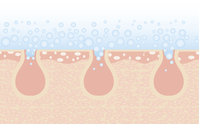 毛孔很大一直不处理会怎么样,毛孔粗大如何改善小技巧儿童