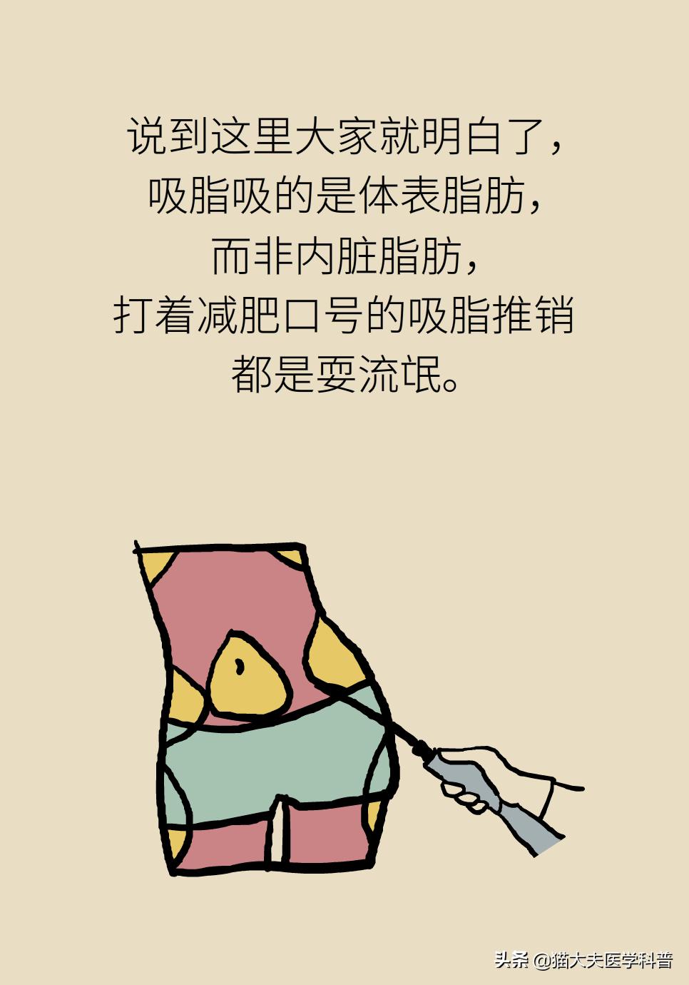 吸脂是怎么吸的,吸脂手术一次就可以吗