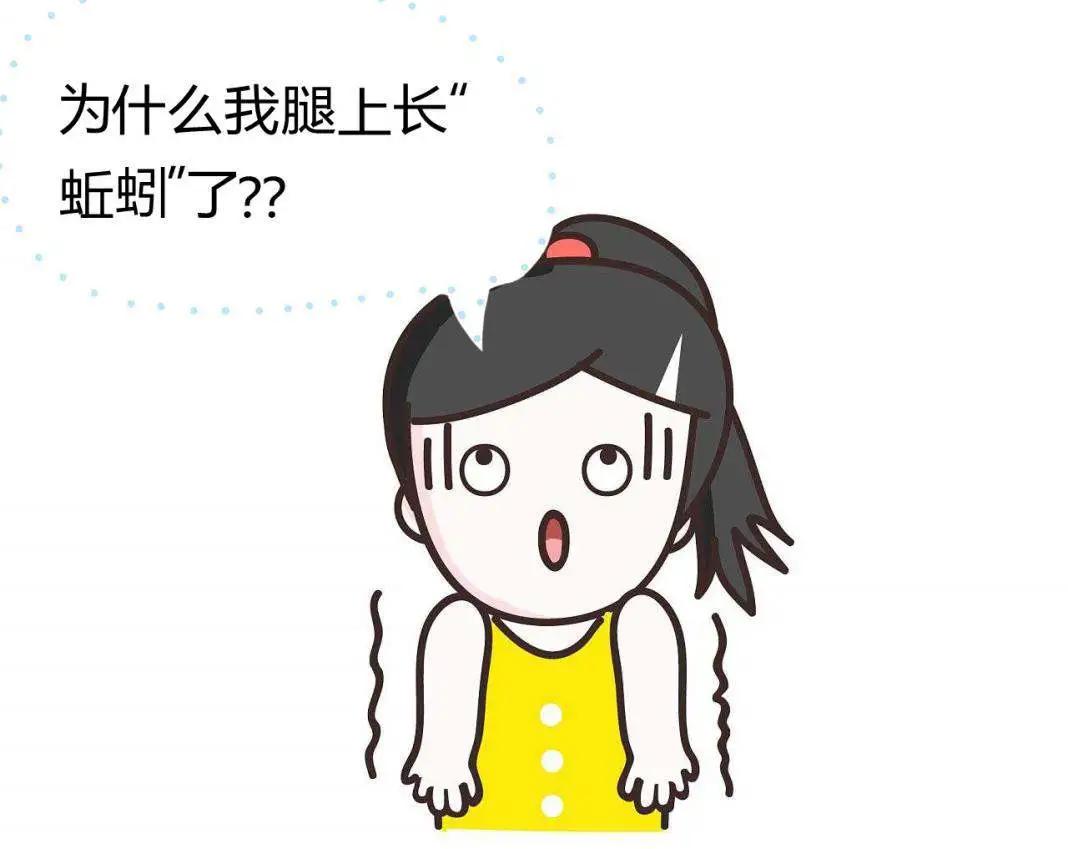 静脉曲张可以用针扎吗,下肢静脉曲张能注射药物治疗吗