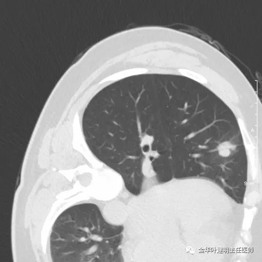 放个大招完整版教学,放个大招完整版前奏