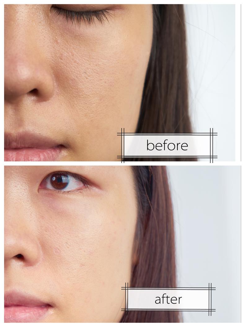 最容易修复晒黑的水乳,去海边怕晒黑穿什么