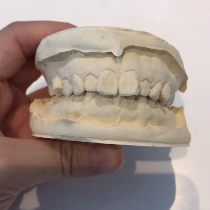 错过青春又如何,错过生长发育期怎么办