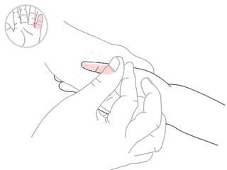 寒包火是属于什么类型感冒,感冒解决妙招