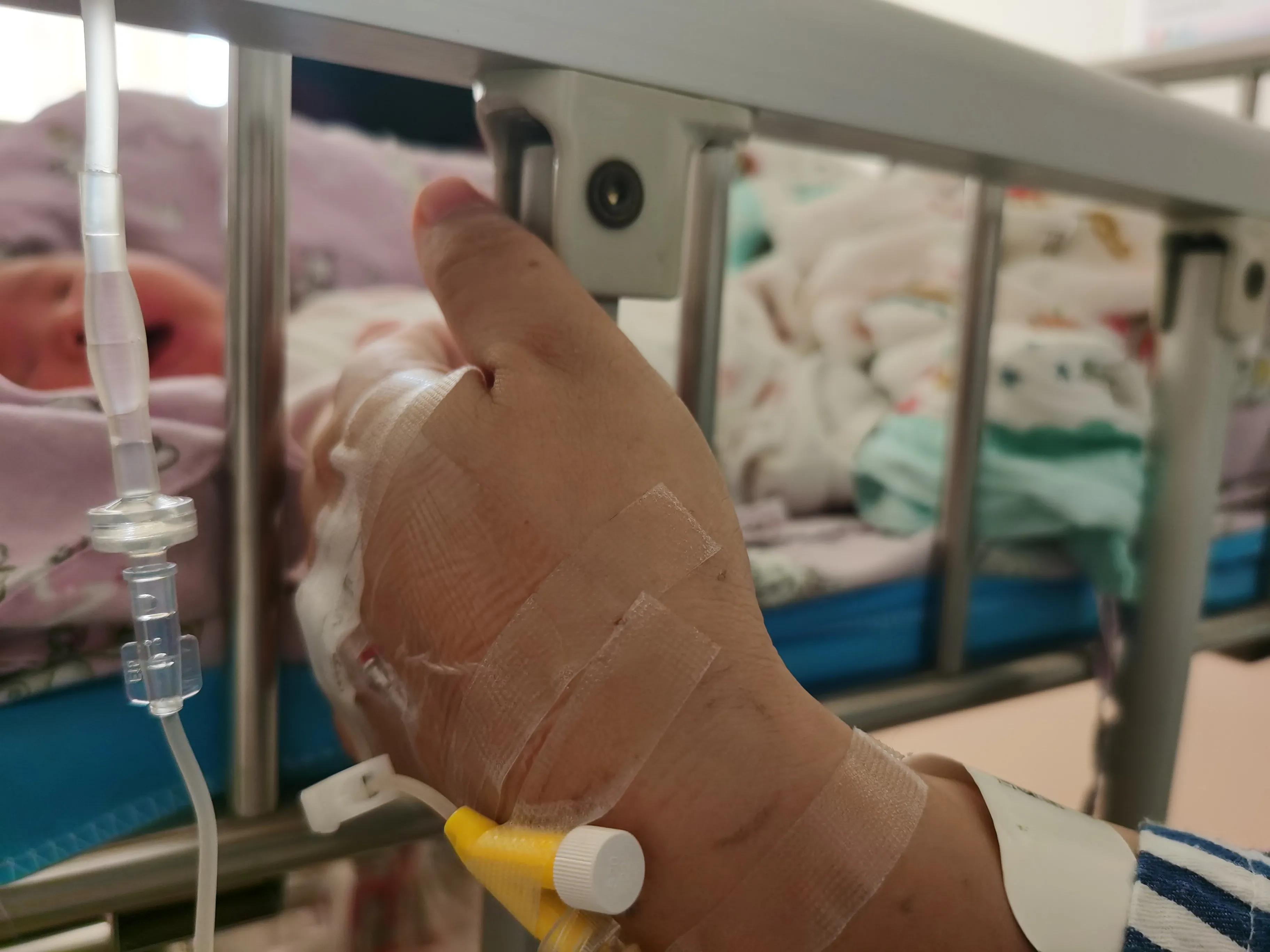 顺转剖腹产后败血症,顺转剖后遗症